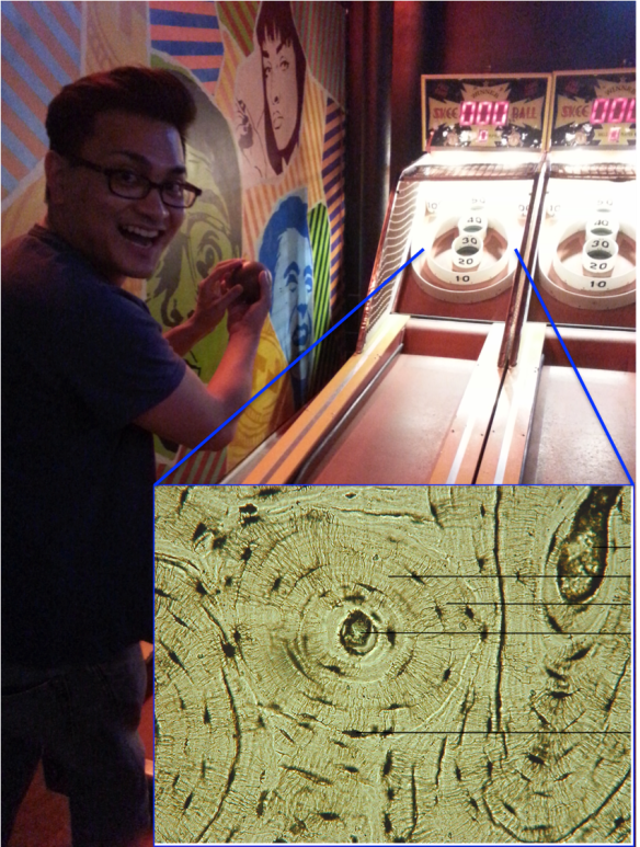 Cross section through cortical bone, magnified to highlight an osteon. The big hole in the center is the Haversian canal, and the smaller satellite holes are lacunae housing osteocytes.